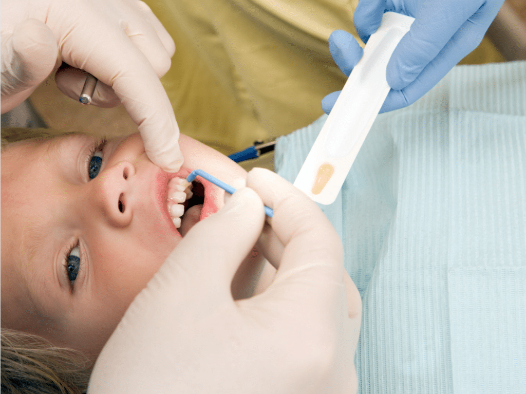 A child getting fluoride treatment in Centerville, Utah